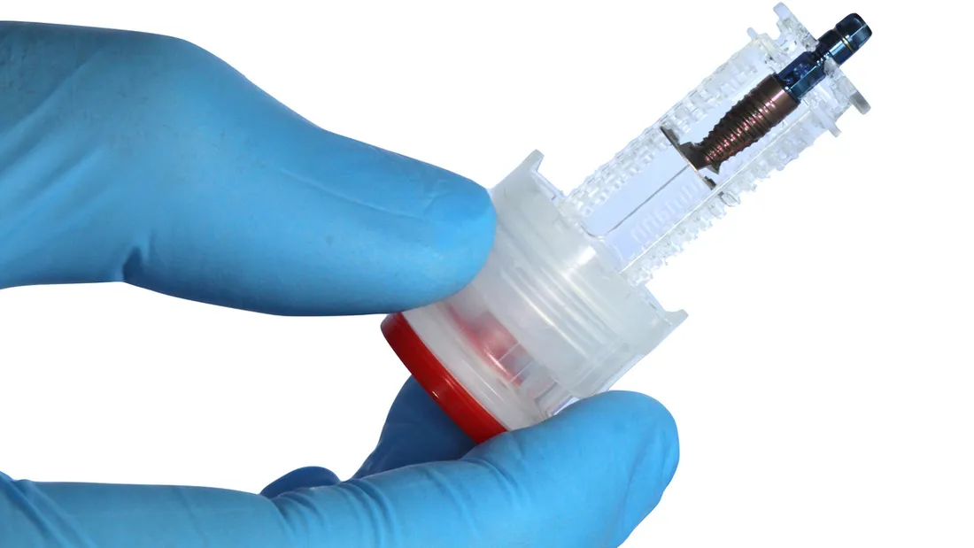 Implante dentário sendo manuseado com luvas cirúrgicas